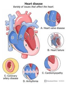 cardiovascular diseaseheart failure symptoms
heart disease symptoms
congenital heart disease
heart problems symptoms
heart problems
symptoms of heart blockage in females
cardiovascular
ischemic heart disease
cardiovascular disease symptoms
