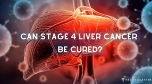 liver cancerhepatocellular carcinoma best treatment for stage 4 liver cancer liver tumor treatment types of liver cancer stage 4 metastatic liver cancer life expectancy stage 4 liver cancer what to expect stage 4 liver cancer liver cancer prognosis best liver cancer treatment in world