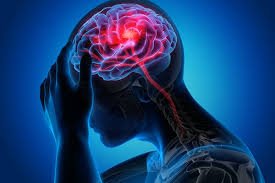 brain hemorrhage hemorrhagic stroke brain bleed symptoms brain bleed hemorrhagic stroke treatment brain bleed from fall small bleed on the brain symptoms intracerebral hemorrhage treatments brain hemorrhage symptoms brain bleed treatment